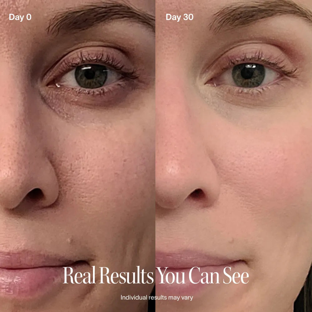 Red Light Therapy Wand & Activating Serum Kit