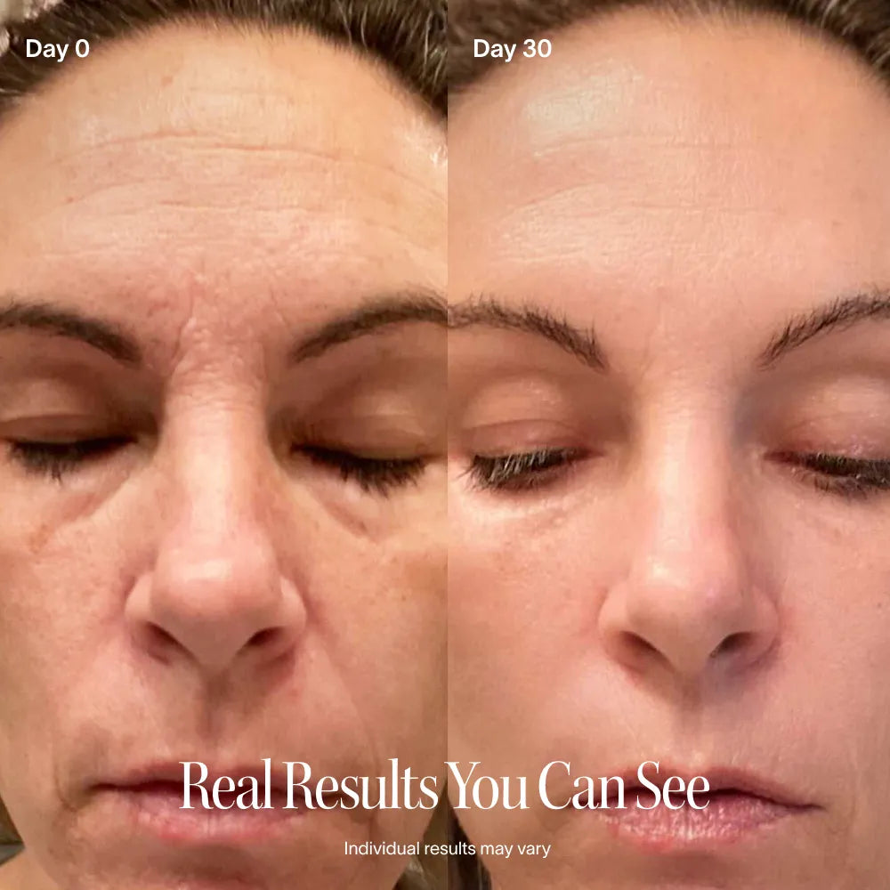 Red Light Therapy Wand & Activating Serum Kit